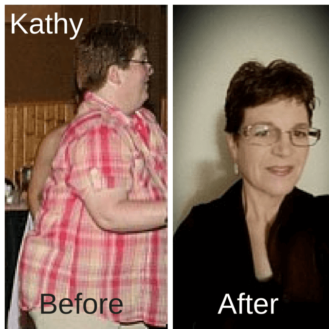 Kathy Before and After