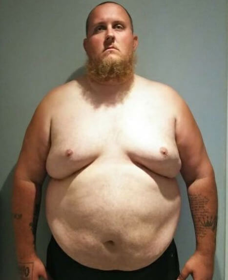 man in a before weight loss photo