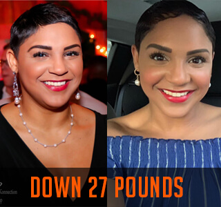 women smiling in weight loss before and after