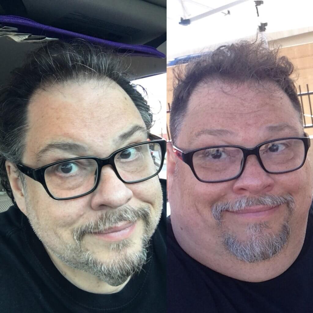 man in before and after weight loss photos